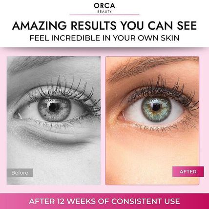 Orca Beauty Anti-Aging Under Eye Cream for Dark Circles/Puffiness/Wrinkles-0.5oz