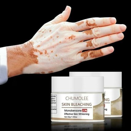 Dark Knuckles Remover Eraser Whitening Cream Bleaching Vitiligo Clear Cream 50g