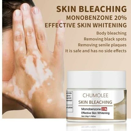 Dark Knuckles Remover Eraser Whitening Cream Bleaching Vitiligo Clear Cream 50g