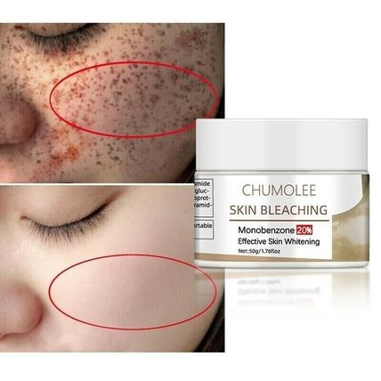 Dark Knuckles Remover Eraser Whitening Cream Bleaching Vitiligo Clear Cream 50g