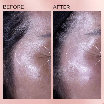 Elizabeth Arden Retinol + HPR Ceramide Capsules Rapid Skin Renewing Serum