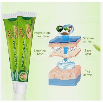 ECZEMA CREAM ANTI ITCHING CREAM ANTI BACTERIAL HERBAL CREAM
