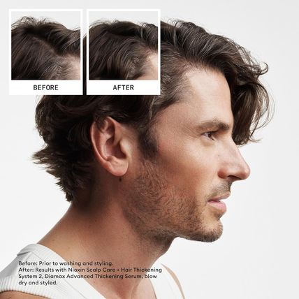 Nioxin System 2 Scalp + Hair Thickening Conditioner for Natural Hair with Progre
