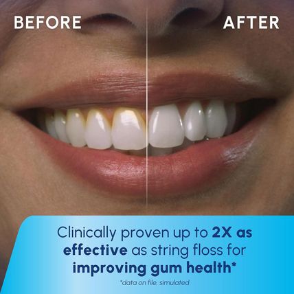 Waterpik Cordless Pearl Rechargeable Portable Water Flosser for Teeth, Gums, Bra