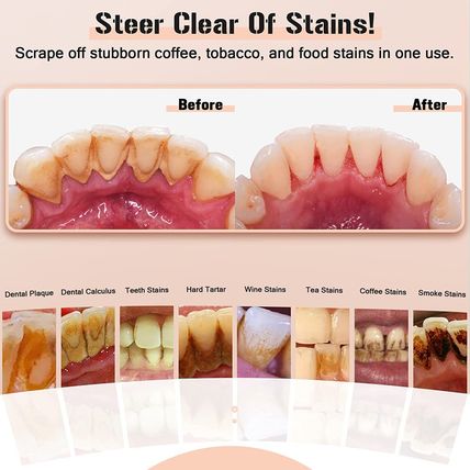 Plaque Remover for Teeth, Electric Tooth Cleaner Tartar Remover for Teeth with L