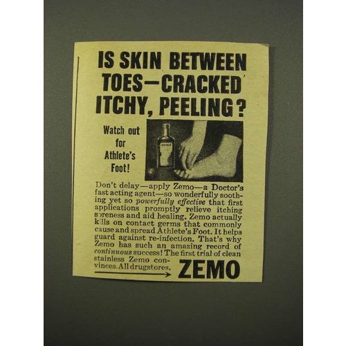 1947 Zemo Ointment Ad - Skin Between Toes Cracked