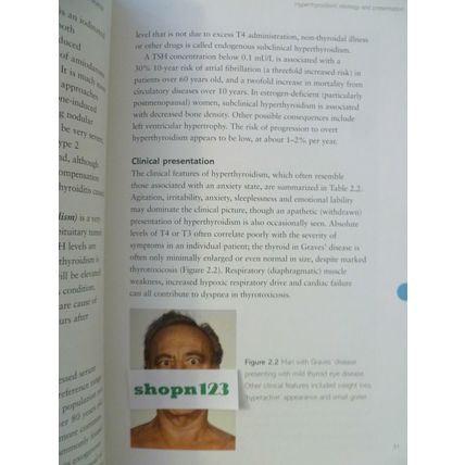 FAST FACTS THYROID DISORDERS by GILBERT H DANIELS & COLIN M DAYAN