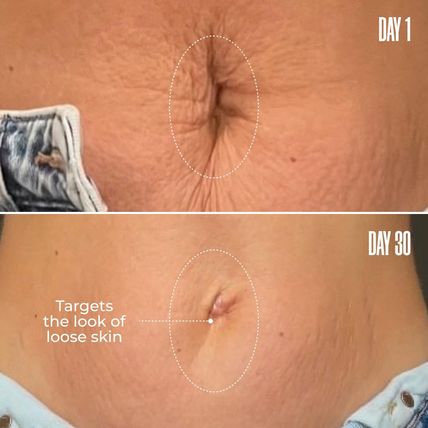 MAËLYS Cosmetics B-FLAT Belly Firming Cream - Stretch Mark, Tightening Belly Cre