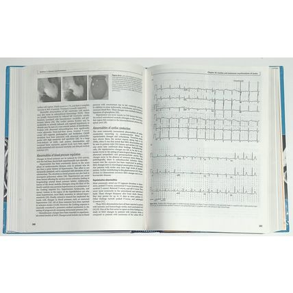 Stroke Syndromes Louis Caplan/Jan Van Gijn Third Edition Cambridge Medicine 2012