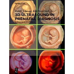 3D Ultrasound in Prenatal Diagnosis