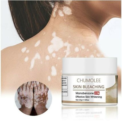 Dark Knuckles Remover Eraser Whitening Cream Bleaching Vitiligo Clear Cream 50g