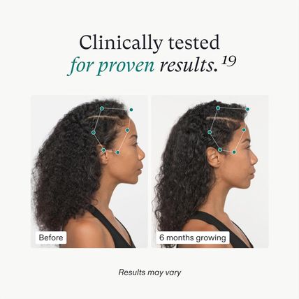 Nutrafol Women'S Hair Growth Supplements, for Women 18-44 Years Old, Clinically