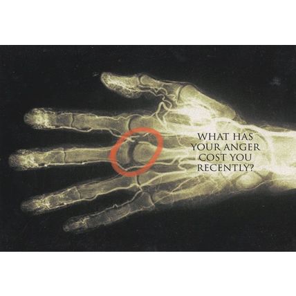 Hand Skeleton Anger Management Advertising Postcard