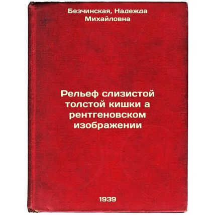Rel'ef slizistoy tolstoy kishki a rentgenovskom izobrazhenii. In Russian /Col...