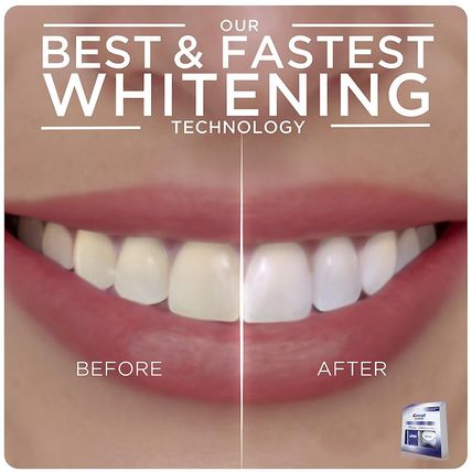 Crest 3D Whitestrips with Light, Whitestrips 3D White, Teeth Whitening Strip Kit