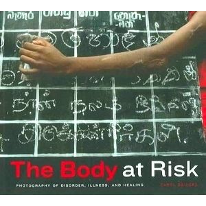 The Body at Risk - Photography of Disorder, Illness, and Healing by Carol Squier