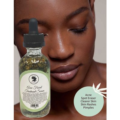 Acne Facial Serum[ ]
