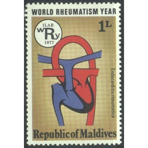 Maldives 1977 - SG726 - 1l multi - Rheumatic Heart - MH