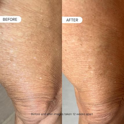 BODY OS-01 Peptide Skin Longevity Daily Moisturizer- Improves Skin Texture & Bar