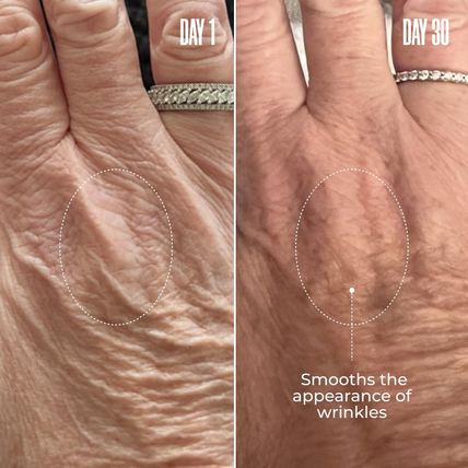 MAËLYS B-GLOSSY Smoothing Body Serum - Anti-Aging Hyaluronic Acid Serum for Body