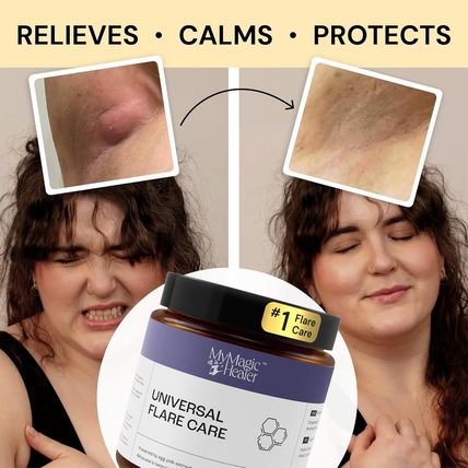 Universal Flare Care | Relief for 97% of Skin Issues | Cysts, Inflamed Skin, Hid