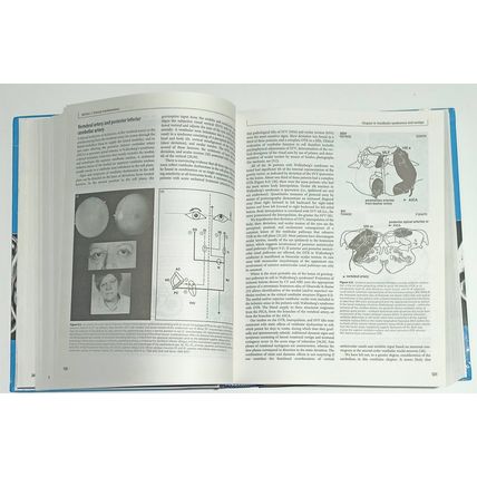 Stroke Syndromes Louis Caplan/Jan Van Gijn Third Edition Cambridge Medicine 2012