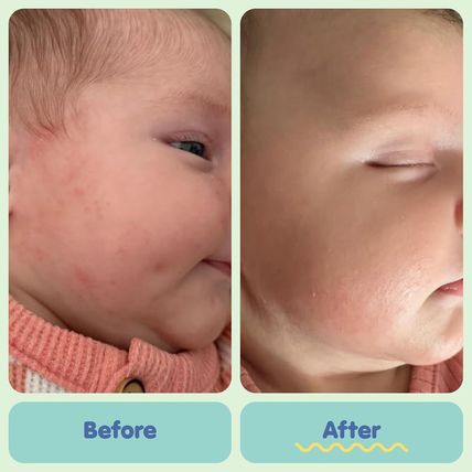 TUBBY TODD All over Ointment - Baby Eczema Cream - Everyday Multi-Purpose Baby S
