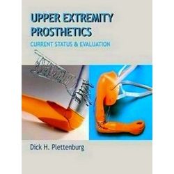 Upper Extremity Prosthetics