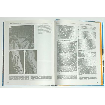 Stroke Syndromes Louis Caplan/Jan Van Gijn Third Edition Cambridge Medicine 2012