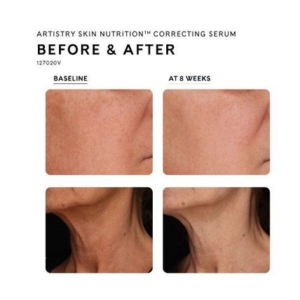 Artistry Skin Nutrition™ Correcting Serum
