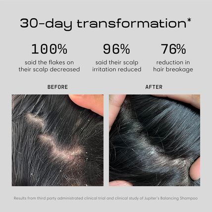 Jupiter, Physician-Formulated Anti-Dandruff Shampoo & Conditioner, for Flaky, It