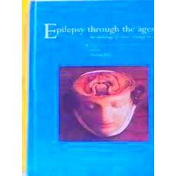 Epilepsy through the ages
