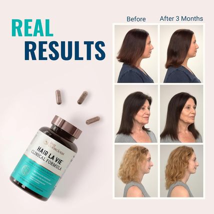 Hair La Vie Live Conscious Clinical Formula Hair Growth Vitamins for Women and M