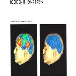 Beelden In Ons Brein