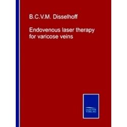 Endovenous laser therapy for varicose veins