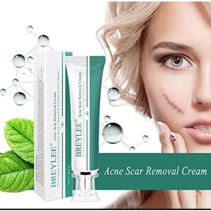 Tratamiento Para El Acne Crema Para Eliminar Espinillas Barros Mancha de la Cara
