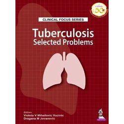 Clinical Focus Series: Tuberculosis
