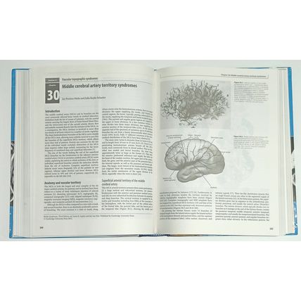 Stroke Syndromes Louis Caplan/Jan Van Gijn Third Edition Cambridge Medicine 2012