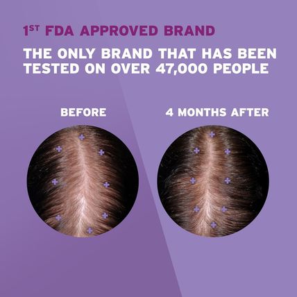 Rogaine Women'S 2% Minoxidil Topical Solution for Womens Hair Thinning and Loss