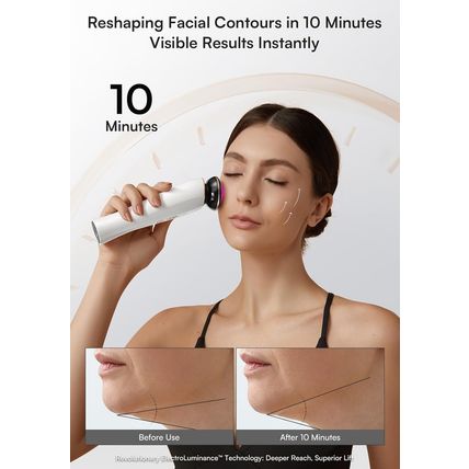 Microcurrent Facial Device, 3-In-1 Facial Massager Red Light Therapy Beauty Devi