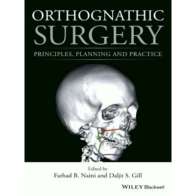 Orthognathic Surgery - Principles, Planning and Practice - Farhad B. Naini