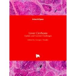 Liver Cirrhosis