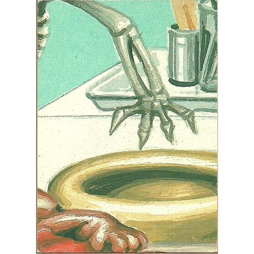 Garbage Pail Kids #451a Destroted Lloyd Trading Card 1987 Topps Chewing Gum