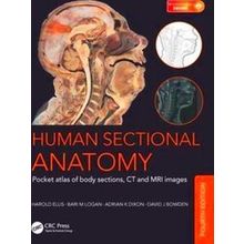Human Sectional Anatomy - Adrian Kendal Dixon