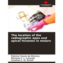 The location of the radiographic apex and apical foramen in molars - Patricia Ya
