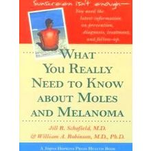 What You Really Need to Know about Moles and Melanoma