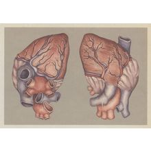 The Heart Anterior & Posterior Morbid Human Anatomy Postcard