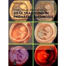 3D Ultrasound in Prenatal Diagnosis
