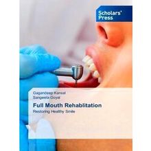 Full Mouth Rehablitation