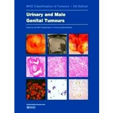 World Health Organization classification of tumours 9: WHO classification of tum
